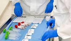 Almaniyada bir gün ərzində koronavirusdan  26 nəfər ölüb