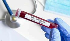 Azərbaycanda 158 nəfər  yeni koronavirus infeksiyasına yoluxub