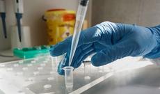 Kanada koronavirusa qarşı peyvəndin ilk sınağının keçirilməsinə razılıq verib