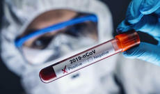 Azərbaycanda koronavirusa yoluxan və ölənlərin bölgələr üzrə son statistikası