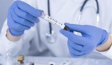 Bakıda koronavirusa yoluxma sayı artıb - STATİSTİKA