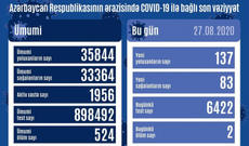 Azərbaycanda daha 137 nəfər COVID-19-a yoluxdu, 83 nəfər sağaldı
