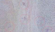 Talış kəndi ətrafındakı əlverişli yüksəkliklər düşməndən təmizlənib