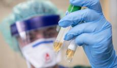 Azərbaycanda koronavirusa yoluxanların sayı yenidən artdı