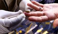 Fevralda nikaha girmək istəyən 97 nəfərdə sifilis, 21 nəfərdə QİÇS aşkarlandı