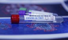 Bakıda koronavirusa ən yüksək yoluxma Binəqədidədir