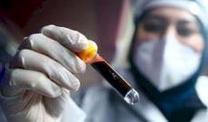 Azərbaycanda daha 1 392 nəfər COVID-19-a yoluxdu