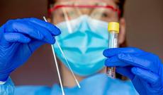 Azərbaycanda daha 4129 nəfər koronavirusa yoluxub, 20 nəfər ölüb