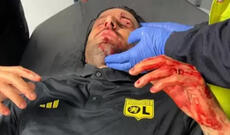 Baş məşqçi başından xəsarət alıb