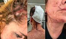 Tatu ustasını və arvadını mismarlanmış ağacla döyüblər