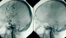 Ölüm zamanı baş verən elektrik aktivliyi ölçülüb