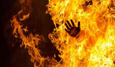 Qadın spirt töküb dostunu yandırdı