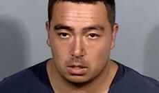 Kişi yoldan keçənə hücum edərək onun gözünü və qulağını yedi