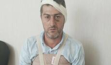 Bərdə sakininin qulağını kəsiblər?