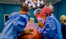 Almatıda qadının qarnından 30 kiloqramlıq nəhəng şiş çıxarılıb