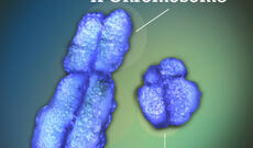 İnsanlarda Y xromosomu yavaş-yavaş yox olur. Bu kişilərin gələcəyi üçün nə deməkdir?