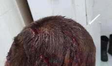 Laçında dəhşətli hadisə: Ayı yerli sakinə hücum etdi