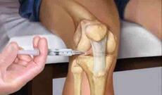 Sümük toxumasını sağaldan pasta yaradılıb