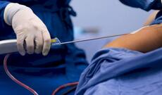 Sumqayıtda 34 yaşlı qadın liposaksiyadan sonra öldü