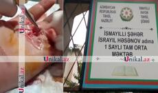 İsmayıllıda şagird sinif yoldaşını yaralayıb - Sinif rəhbəri hadisəni gizlədib -Səs yazısı