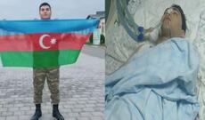 Vətən müharibəsinin iştirakçısı narkozdan sonra komaya düşdü - 72 saat vaxt qoyuldu