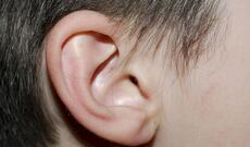 Sumqayıtda 35 yaşlı kişi tanışının qulağını dişləyərək qopardı