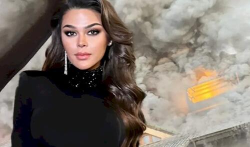 Türkiyənin tanınmış aktrisasının villası yandı: xəstəxanaya yerləşdirildi - FOTO