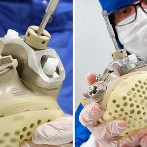 Fransız alimləri ürək çatışmazlığının müalicəsində ümidverici bir kəşf etdilər