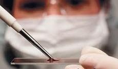 Süni mayalanma pulsuz ola bilər