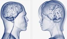 Kişi və qadın beyni nə ilə fərqlənir?