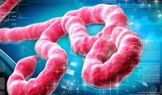 Rusiyada "Ebola" virusuna qarşı peyvənd icad olunub