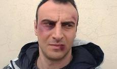 Tanınmış idmançı Ceyhun Vəliyevin döyülmə xəbəri rezonans doğurub - FOTO