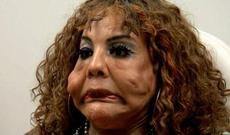 Əvvəl kişi, sonra qadın, indi eybəcər məxluq - FOTO