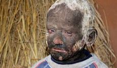 11 yaşlı uşaq gün-gündən daşlaşır