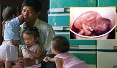 O, abort edilmiş uşaqların cəsədlərini klinikadan alır və... — FOTO