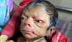 80 yaşında doğulan körpə - FOTO