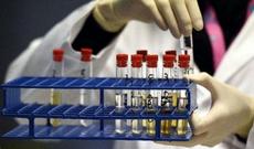 İdmançısında dopinq tapılan federasiyanın pulu kəsiləcək