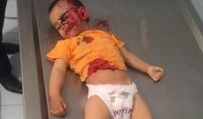 Ermənilərin qətlə yetirdiyi 2 yaşlı Zəhranın ürəkparçalayan - FOTOSU