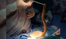 Qarnı ağrıyan şəxsin qarnından ilan çıxdı - Şok