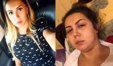 Xəstəlik azərbaycanlı müğənnini bu hala saldı