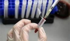 Nİkaha girmək istəyən 16 nəfərdə sifilis, 11 nəfərdə isə QİÇS aşkarlanıb