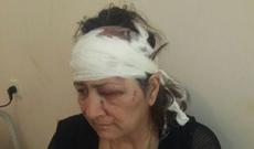 Azərbaycanda qayınana kürəkəni tərəfindən döyüldü