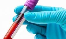 Alimlər qan qrupunu dəyişməyin yeni üsulunu tapıblar