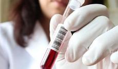 Azərbaycanın 5 idmançısı cəzalandırıldı