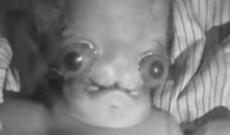 “Azərbaycandakı 478 ailədə sırf heyvanabənzər uşaqlar doğulub və...”