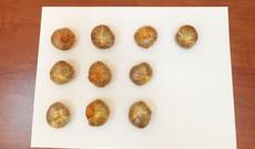 Daxili orqanından narkotik vasitə aşkarlandı