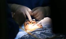 İranın səhiyyə tarixində ilk dəfə olaraq üz köçürülməsi tibbi əməliyyatı keçirilib