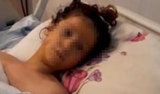 Transformatora girən azyaşlının 2 ayağı və qolu amputasiya edildi