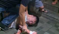 Honkonqda millət vəkilinin qulağını dişlədilər