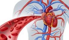 Damar tıxanmasına və insulta səbəb olan QİDALAR